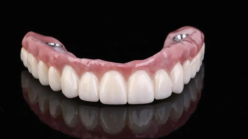 Broken and Failing Implants in Kansas City at Gordon Dental Implants and Cosmetics