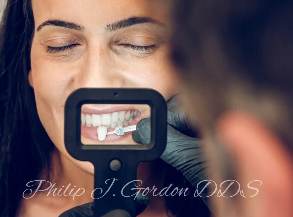 Close-up of a patient’s teeth showing durable porcelain veneers at Gordon Dental Implants and Cosmetics in Kansas City