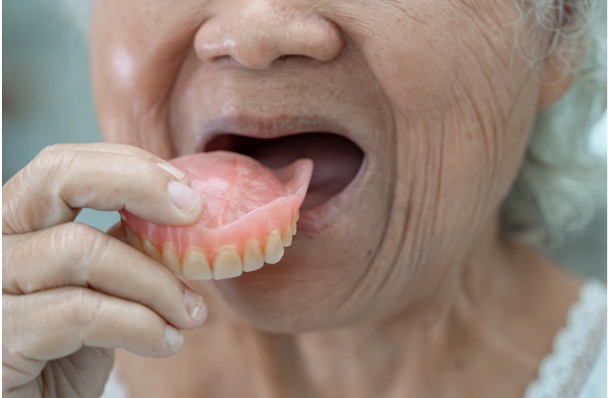 What’s the Better Long-Term Solution Dental Implants vs. Dentures
