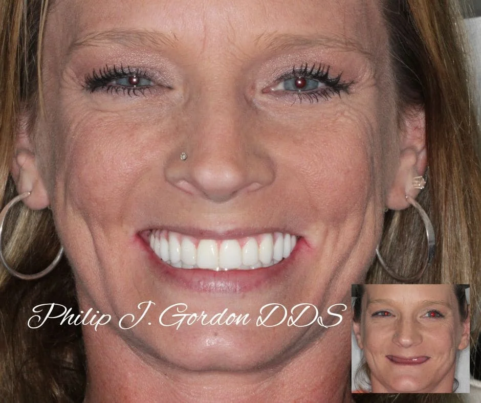 Reclaiming Your Life from Failing Teeth