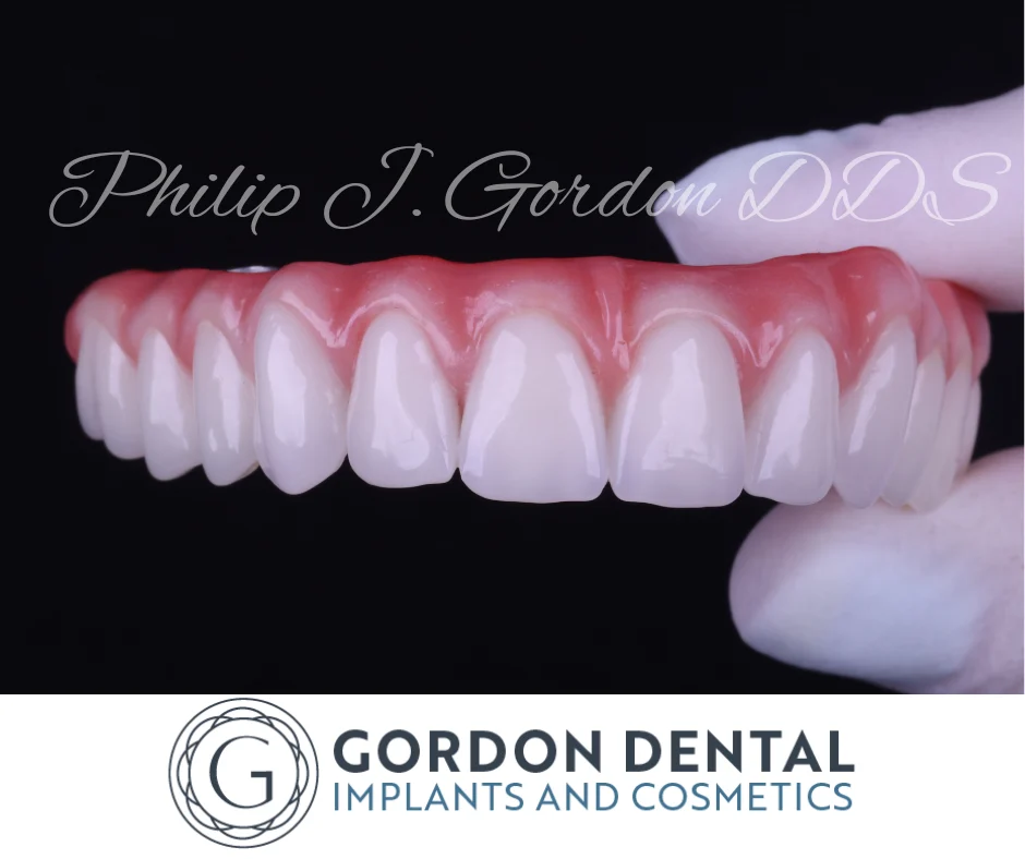 Replacing Failing Dentistry Bill’s Full-Arch Restoration in Kansas City