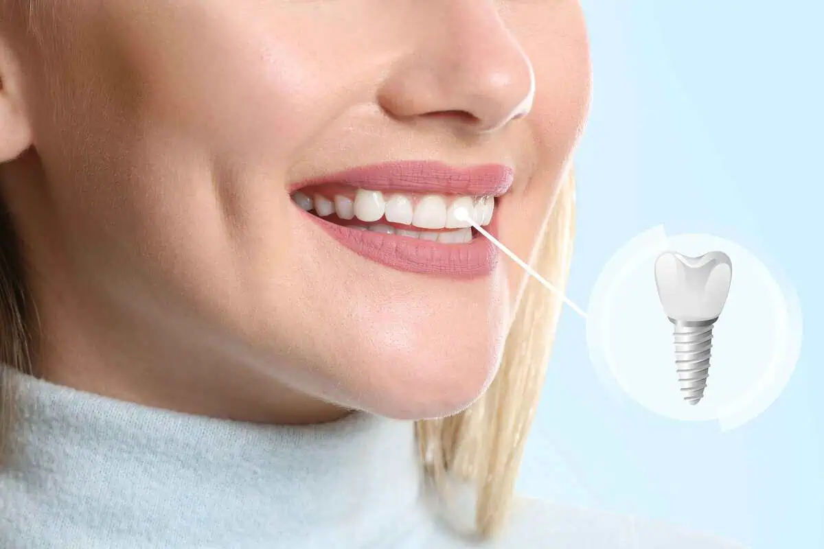 dental implant cost and treatment options in Kansas City