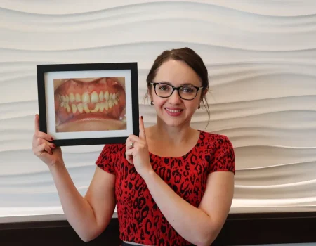 Gordon Dental Implants and Cosmetics Before and After A