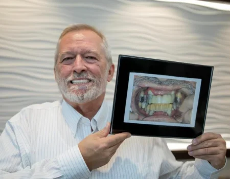Gordon Dental Implants and Cosmetics Before and After B