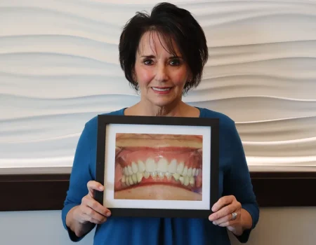 Gordon Dental Implants and Cosmetics Before and After C