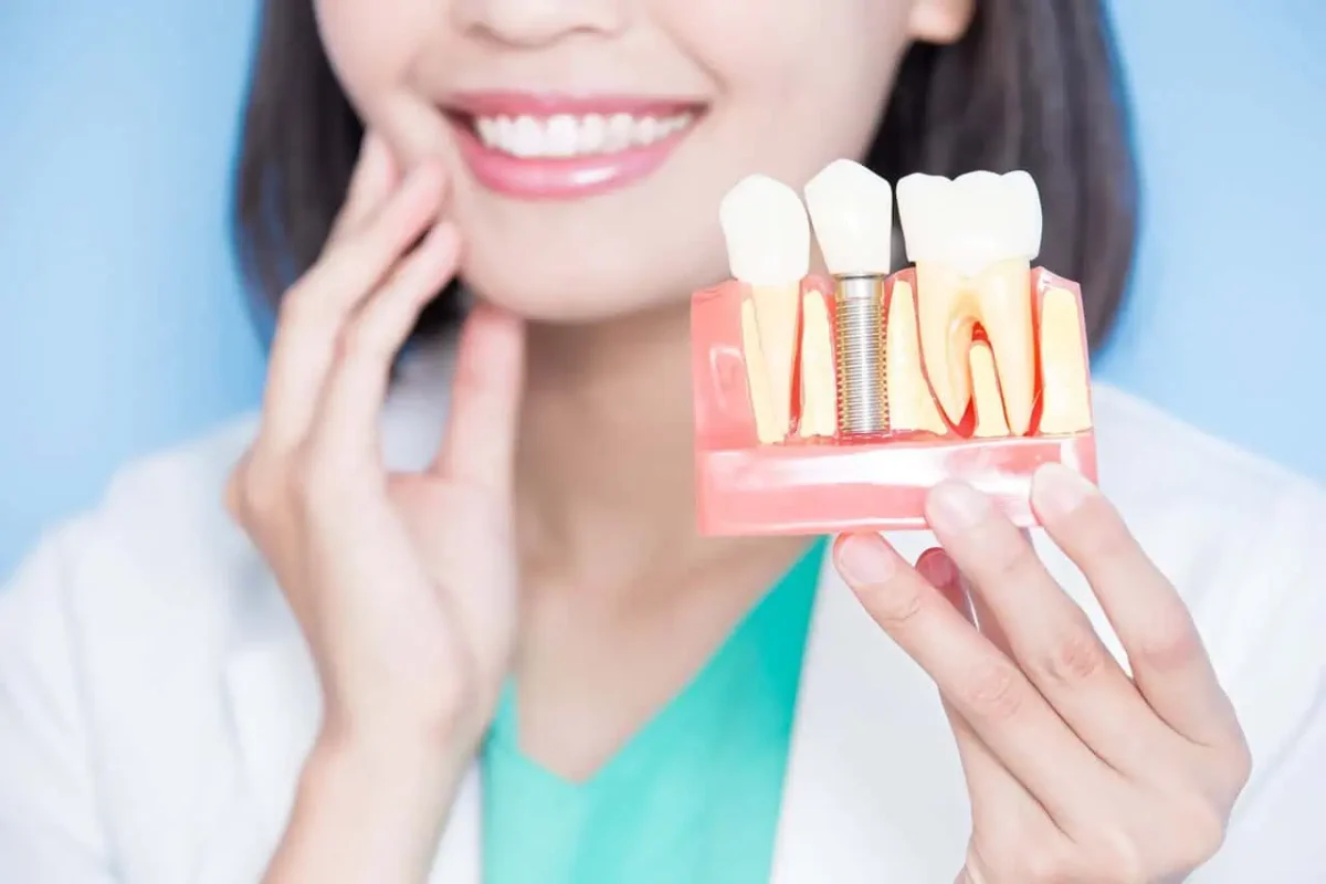 Why Dental Implants is Alternative to Root Canal Treatment?