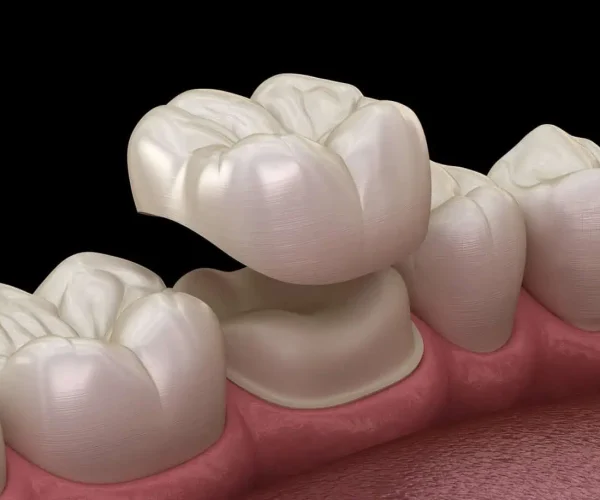 Comprehensive General Dentistry in Kansas City, KS