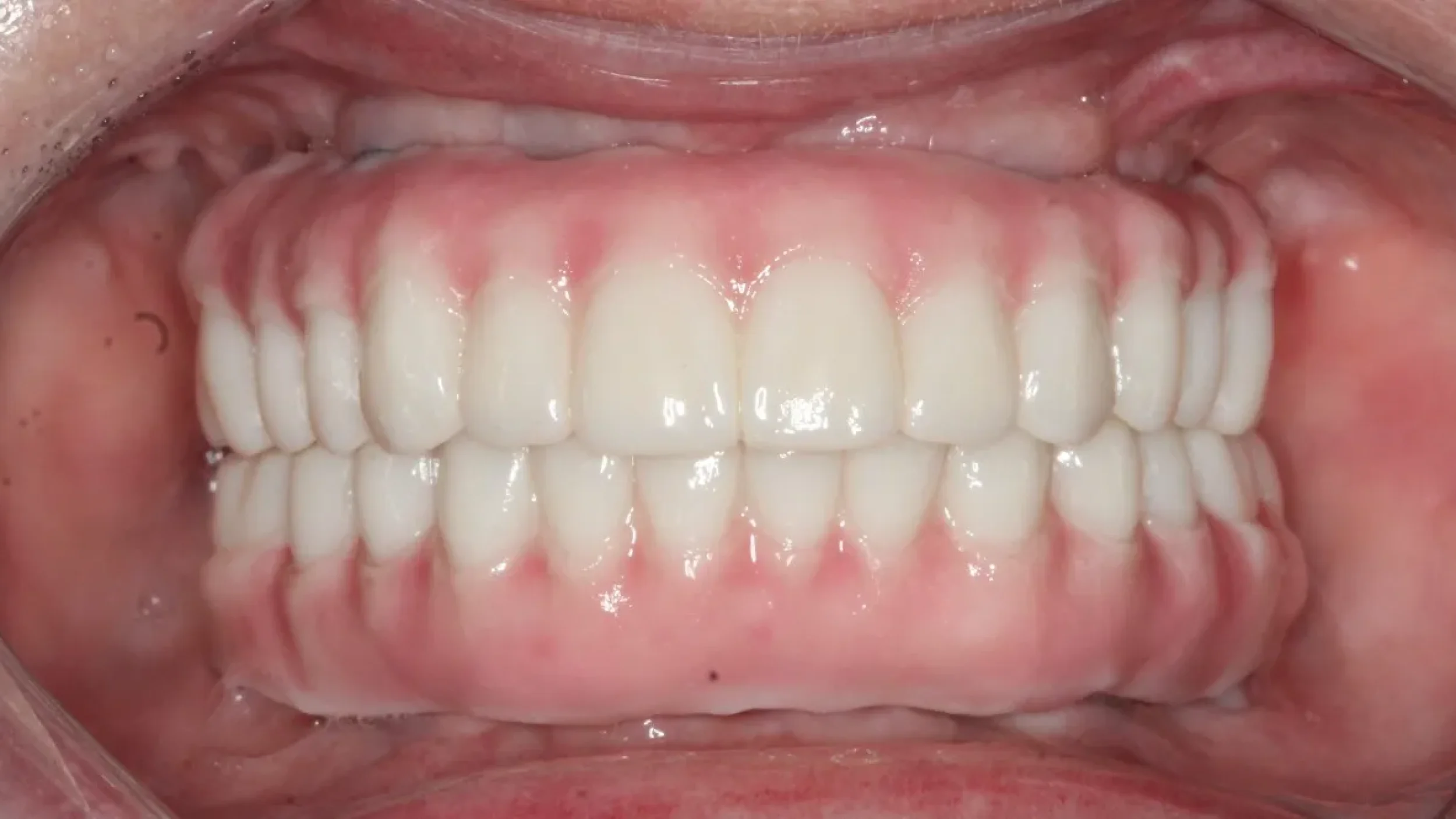 Dental Smile Gallery After E in Kansas City