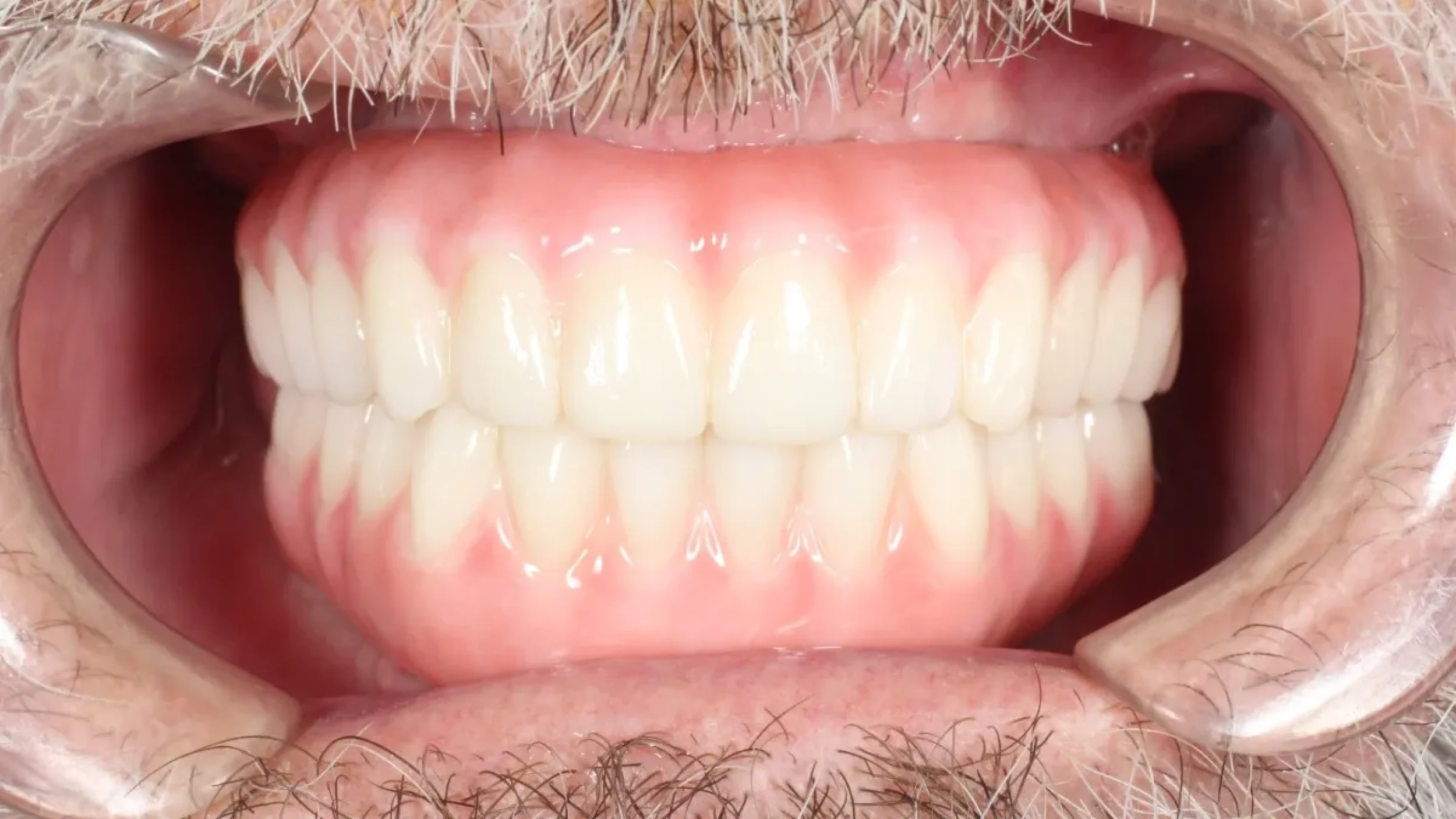 Dental Smile Gallery After G in Kansas City