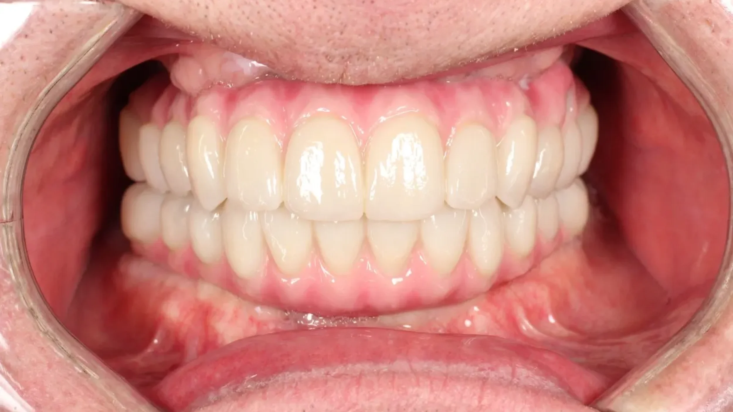Dental Smile Gallery After K in Kansas City