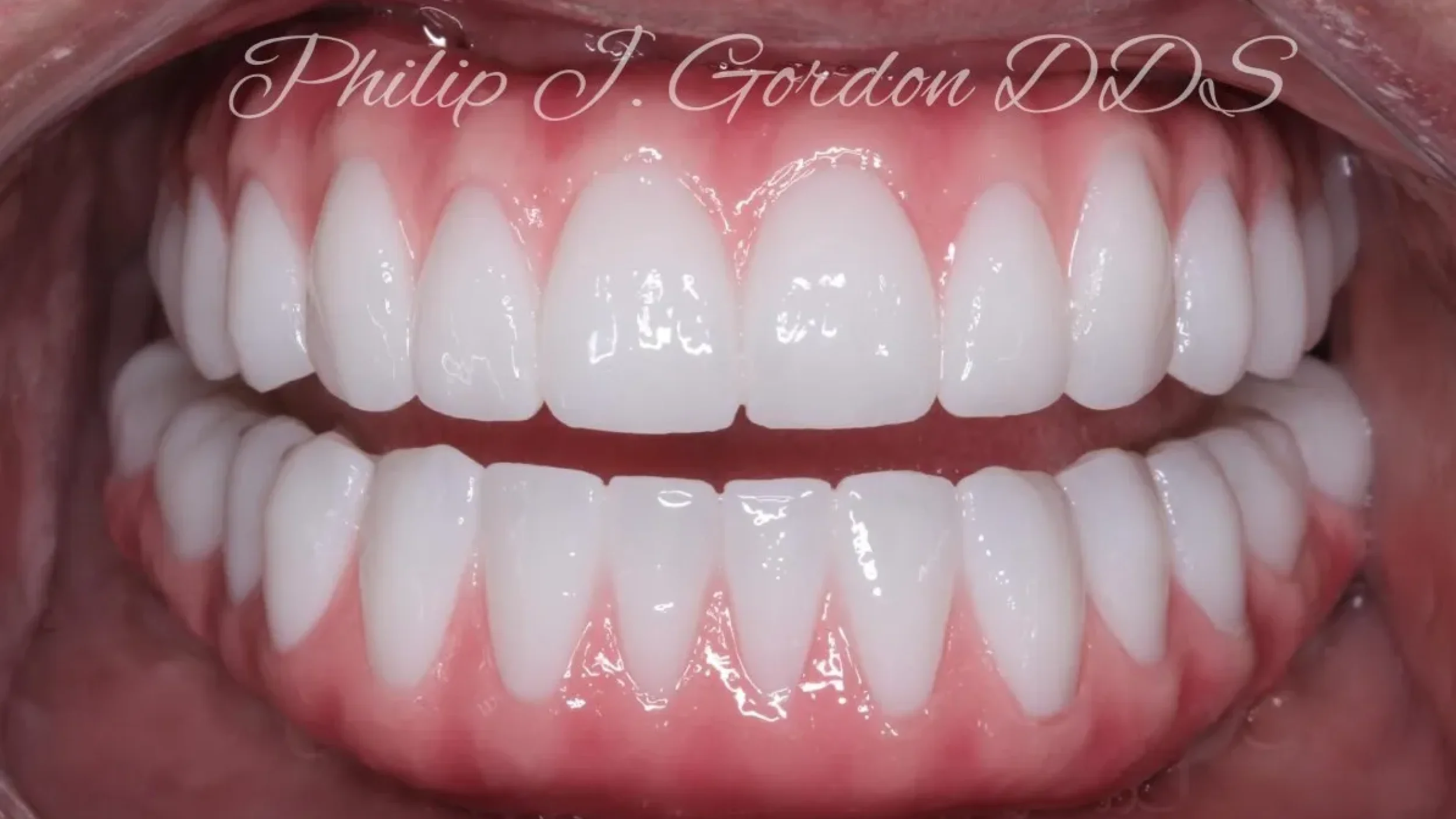 Dental Smile Gallery After L in Kansas City