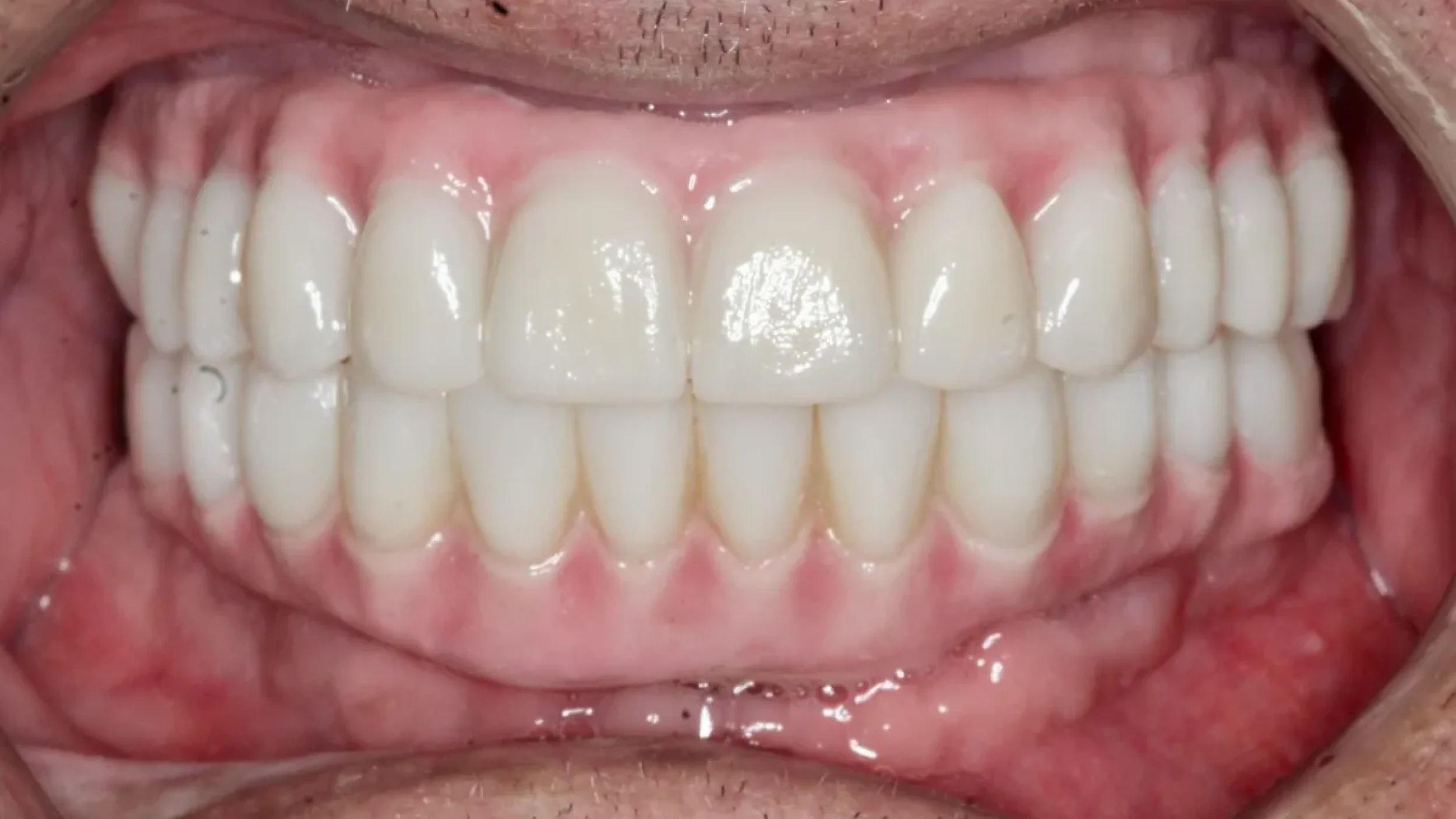 Dental Smile Gallery After M in Kansas City