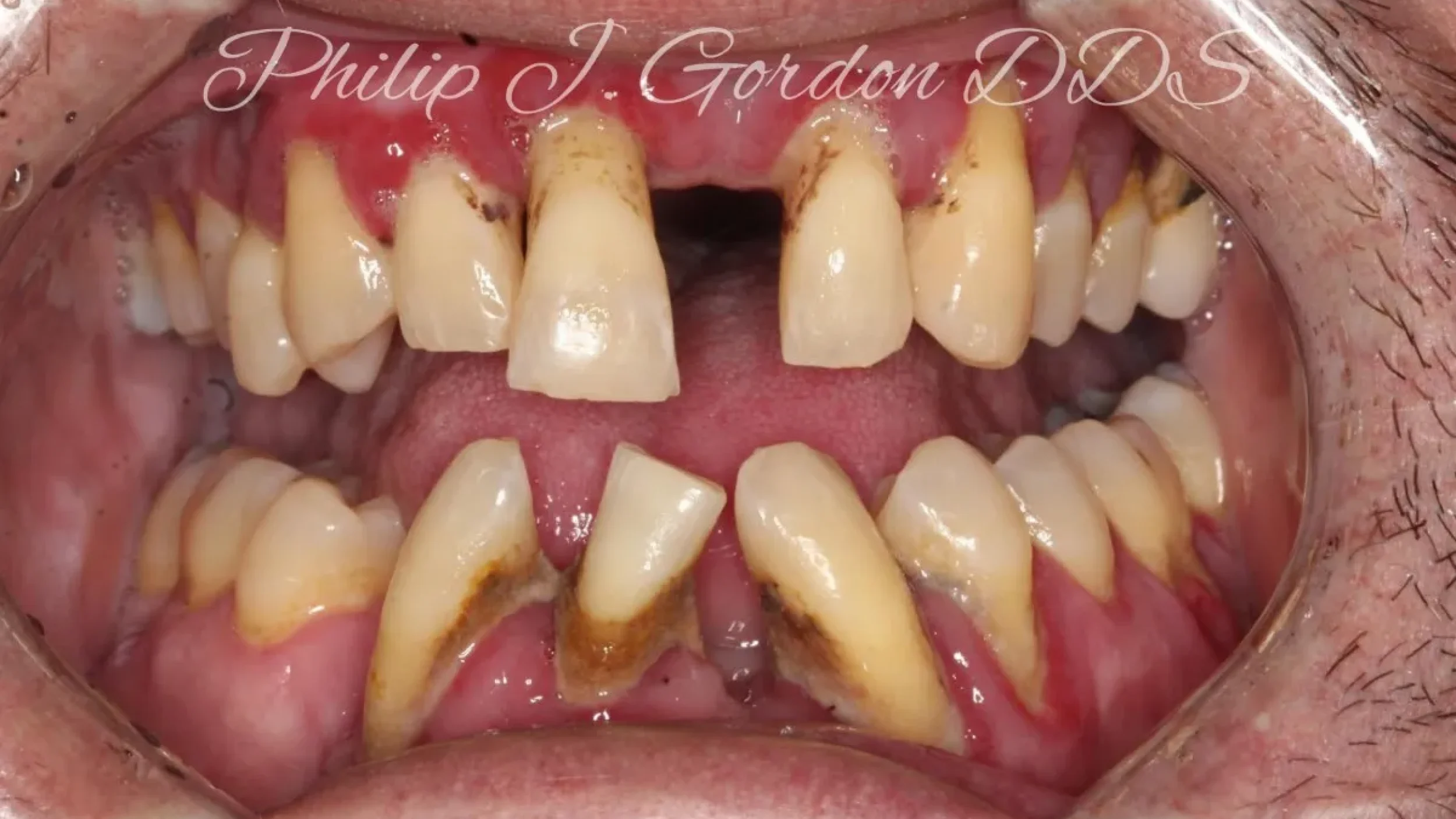 Dental Smile Gallery Before L in Kansas City