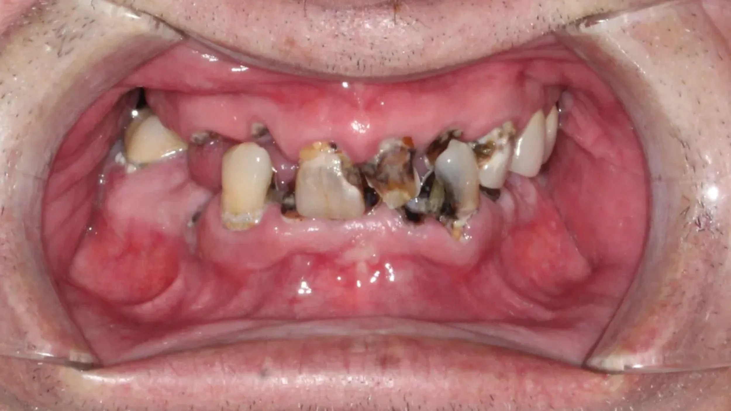 Dental Smile Gallery Before M in Kansas City