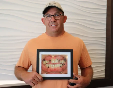 Gordon Dental Implants and Cosmetics Before and After