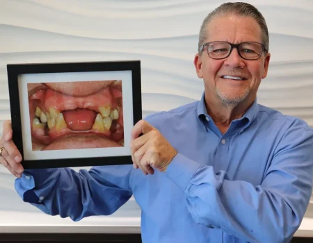 Gordon Dental Implants and Cosmetics in Kansas City Before and After
