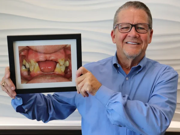Gordon Dental Implants and Cosmetics in Kansas City Before and After