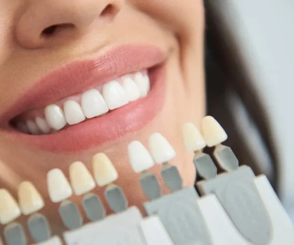 Full-Mouth Crowns in Kansas City at Gordon Dental Implants and Cosmetics