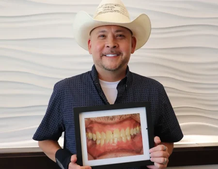 Gordon Dental Implants and Cosmetics Before and After