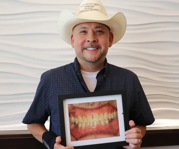 Gordon Dental Implants and Cosmetics Before and After