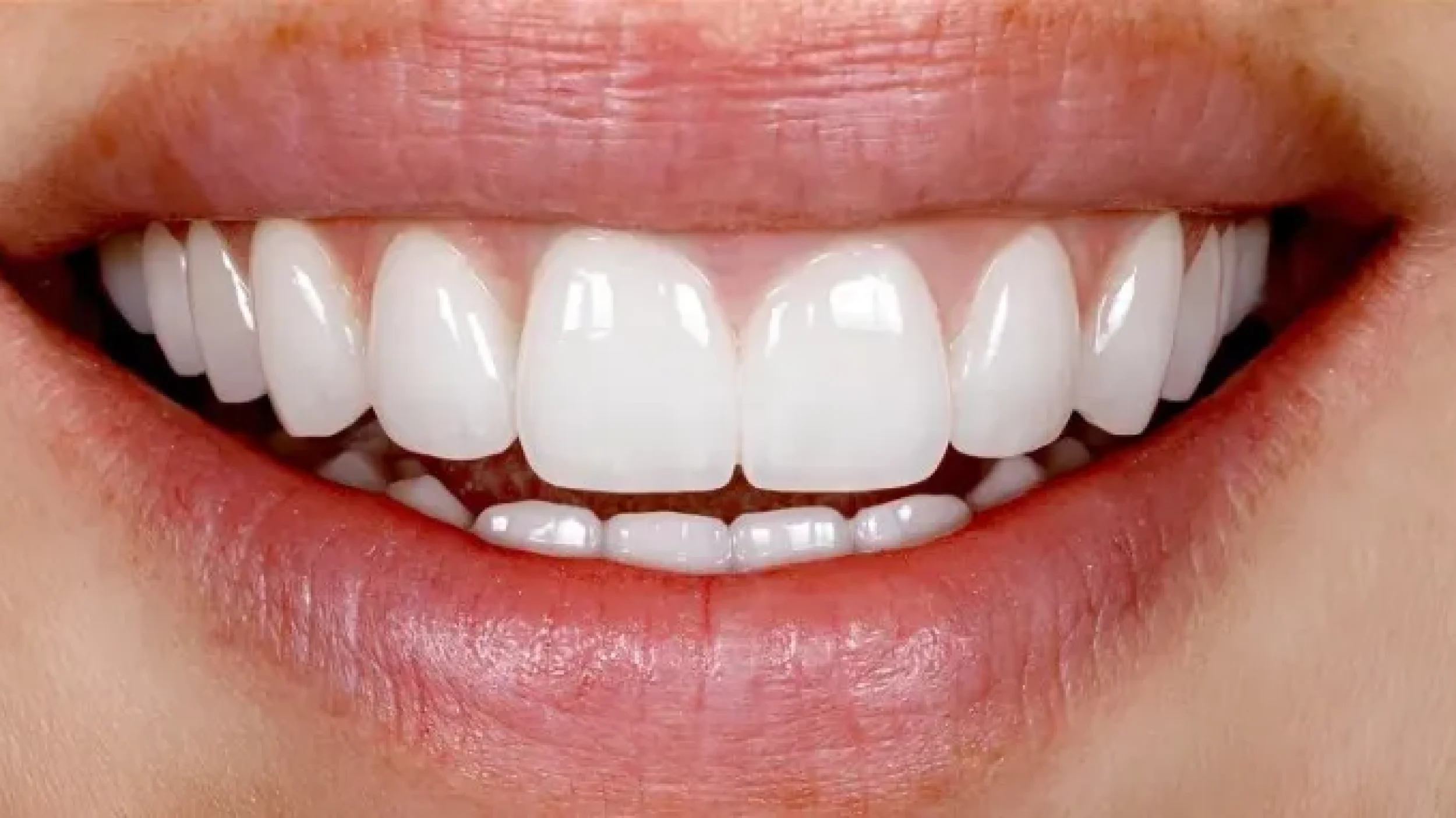 Gordon Dental Implants And Cosmetics Before After NNN