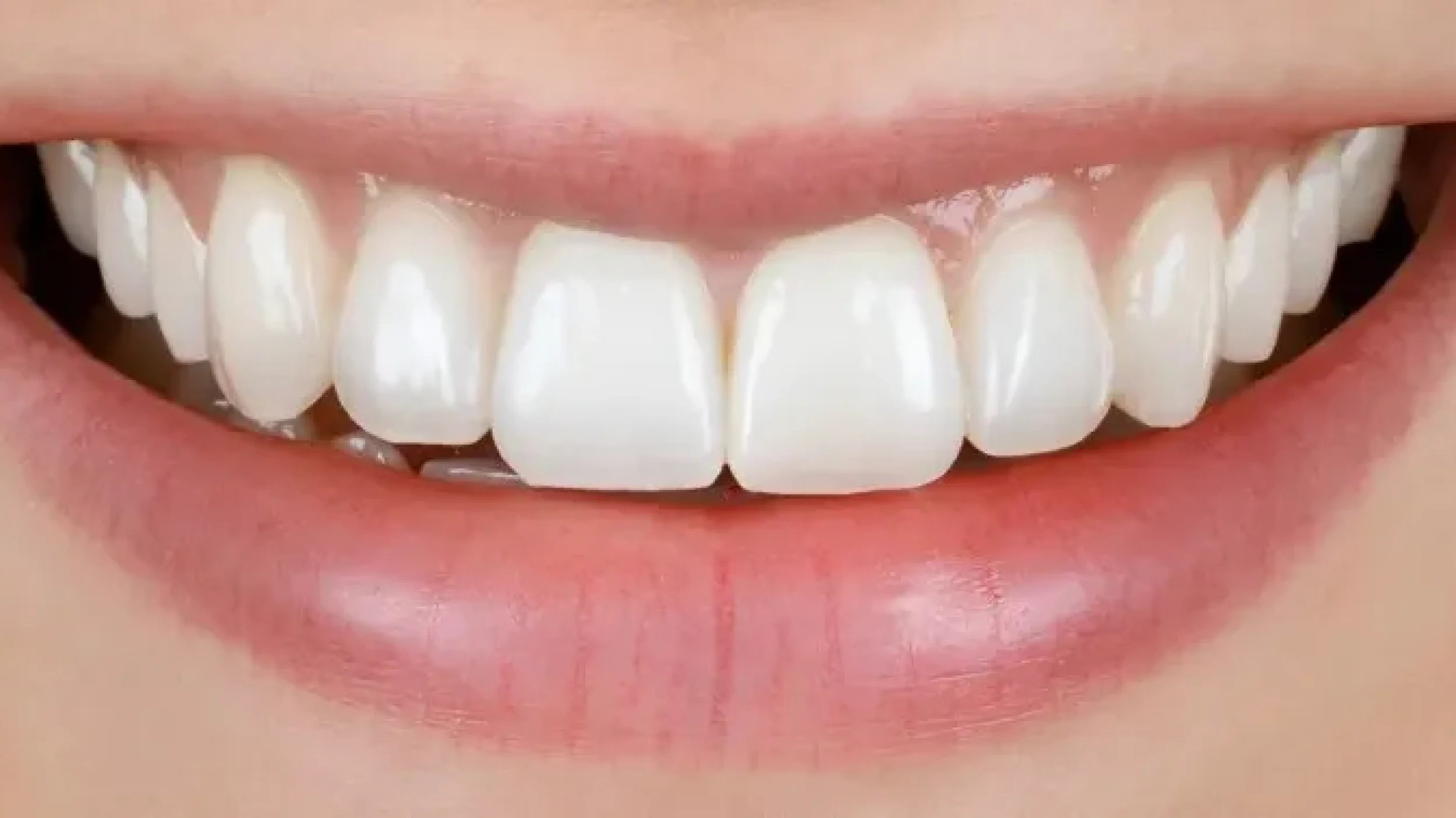 Gordon Dental Implants And Cosmetics Before After OOO