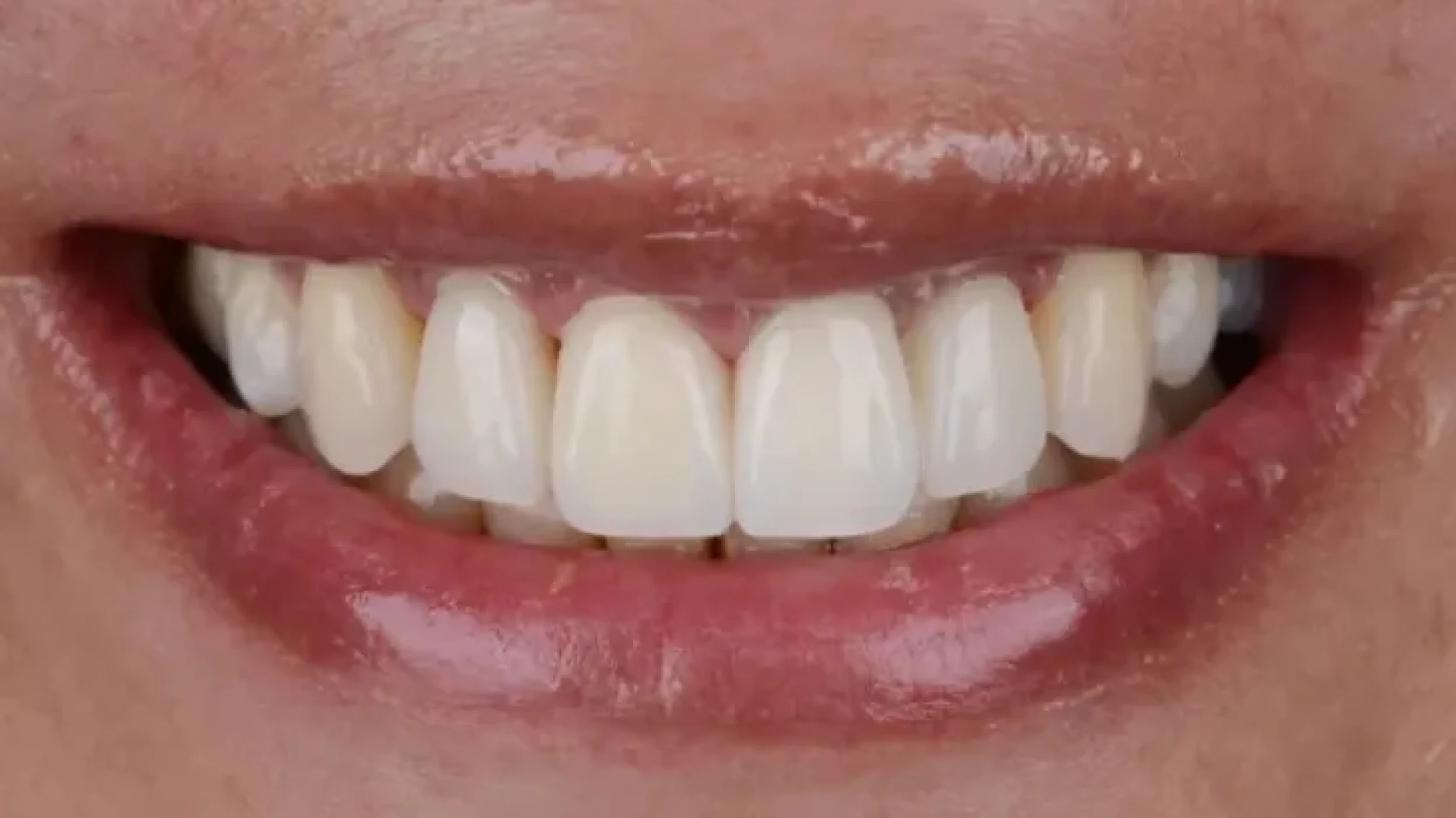 Gordon Dental Implants and Cosmetics Before After DD