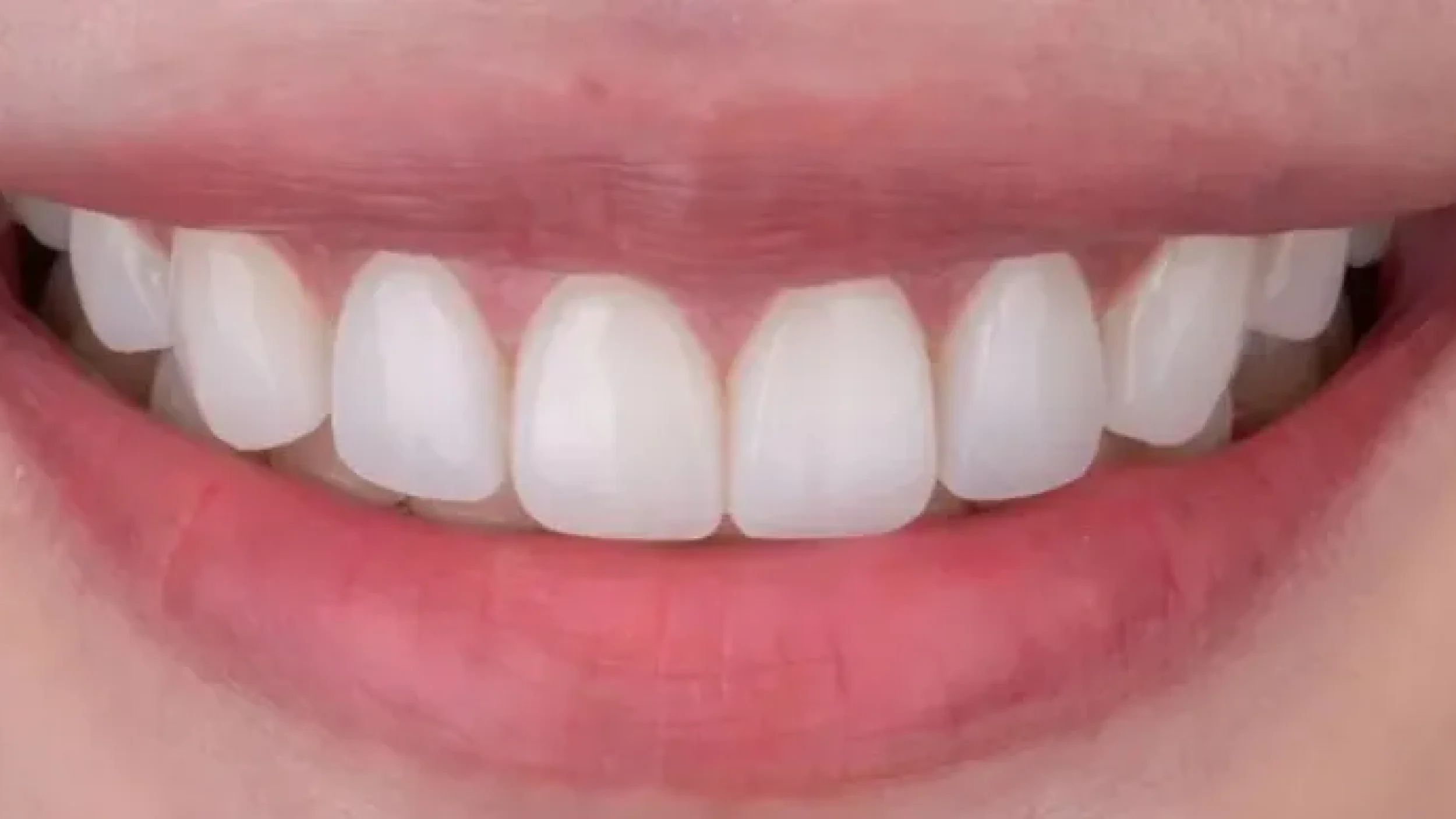 Gordon Dental Implants and Cosmetics Before After GG