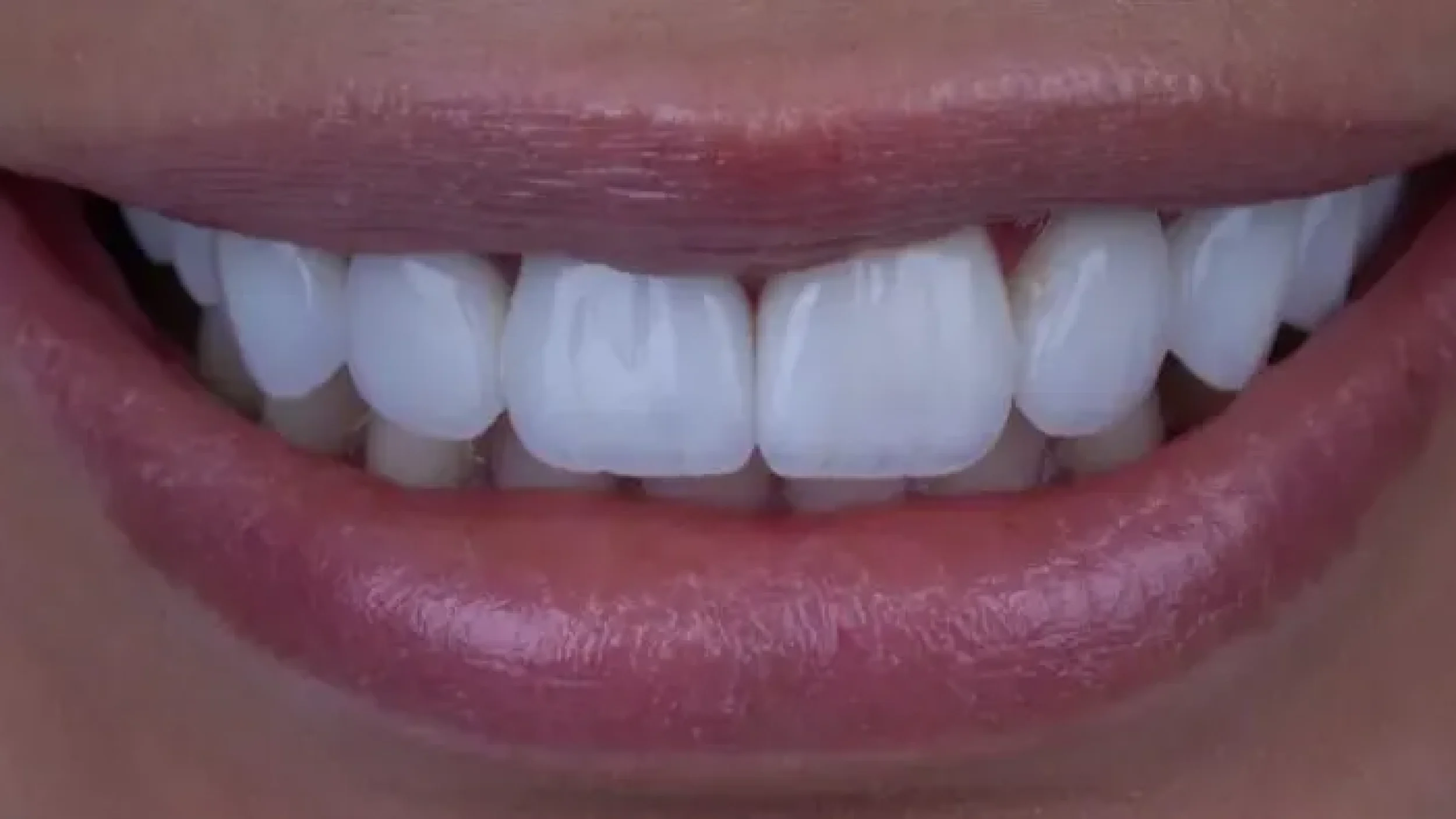 Gordon Dental Implants and Cosmetics Before After 3