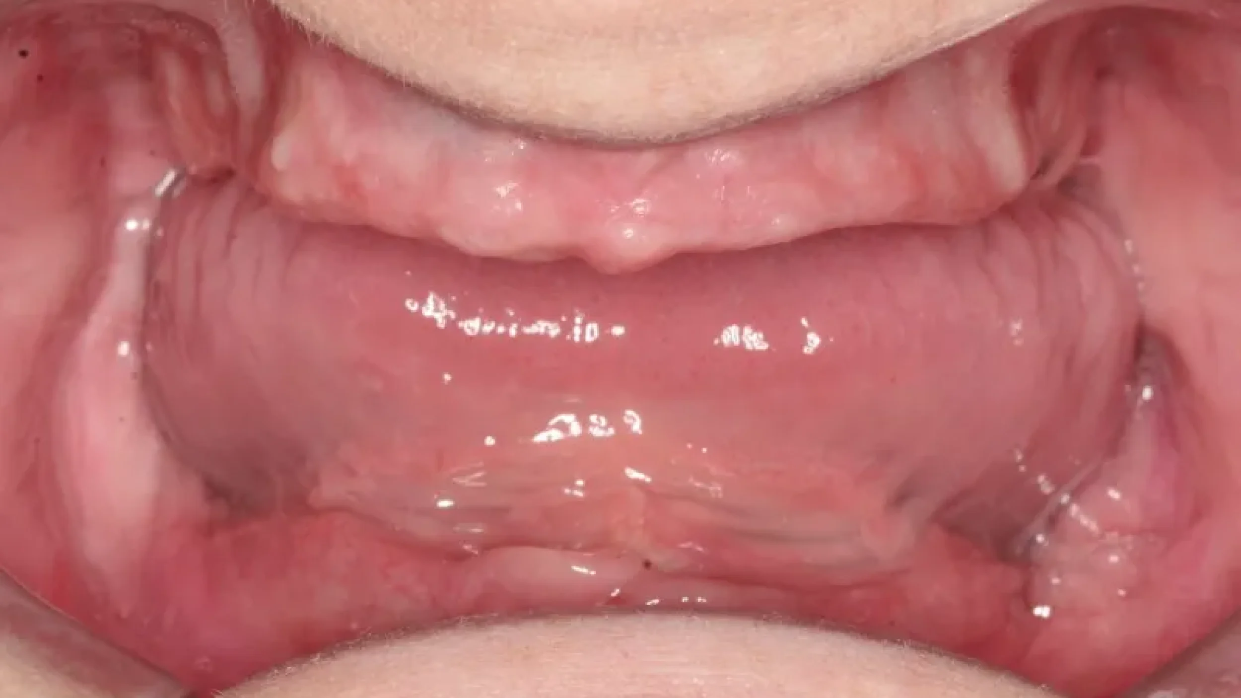 close up of a person's mouth