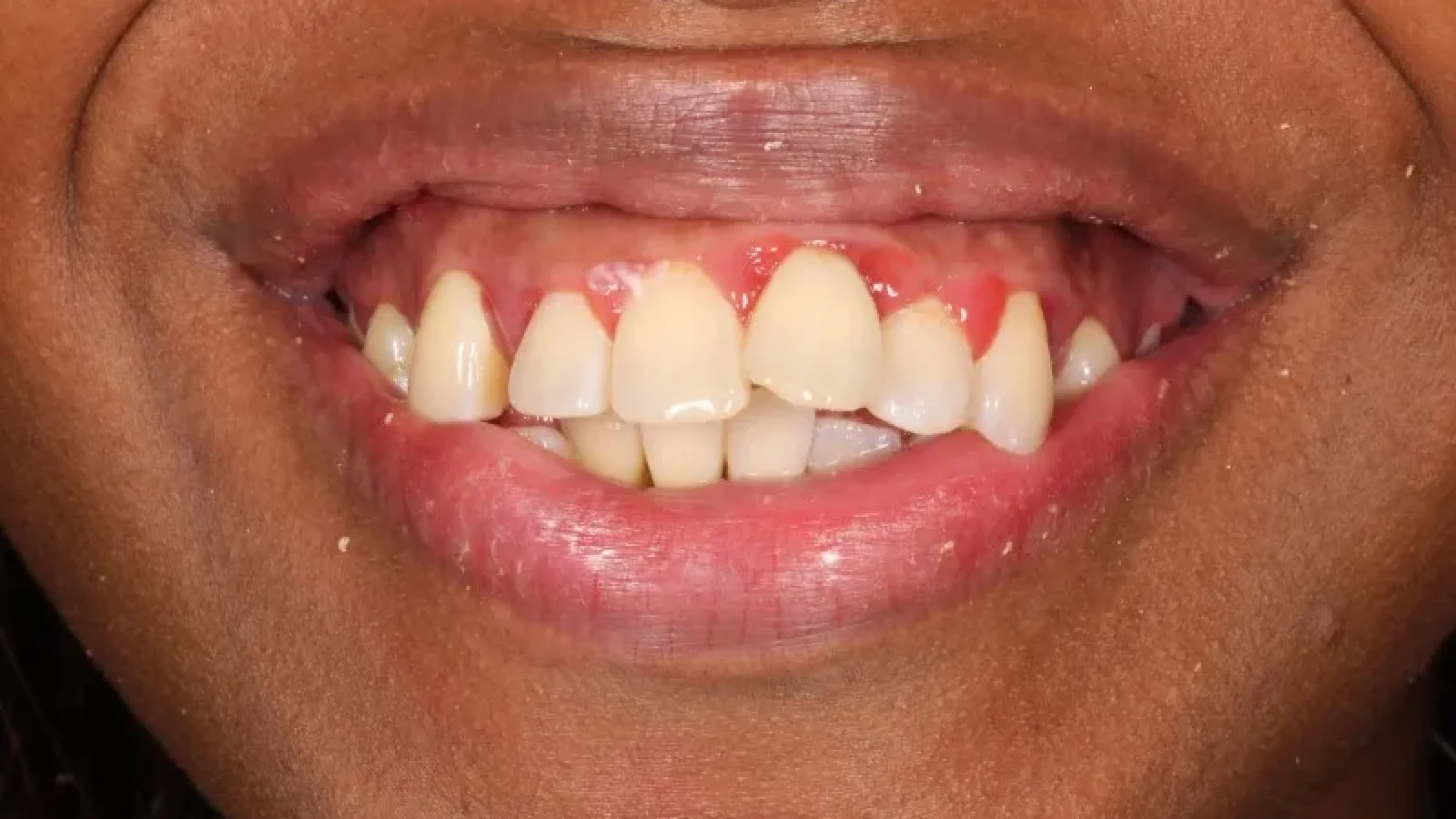 Gordon Dental Implants and Cosmetics Before 1