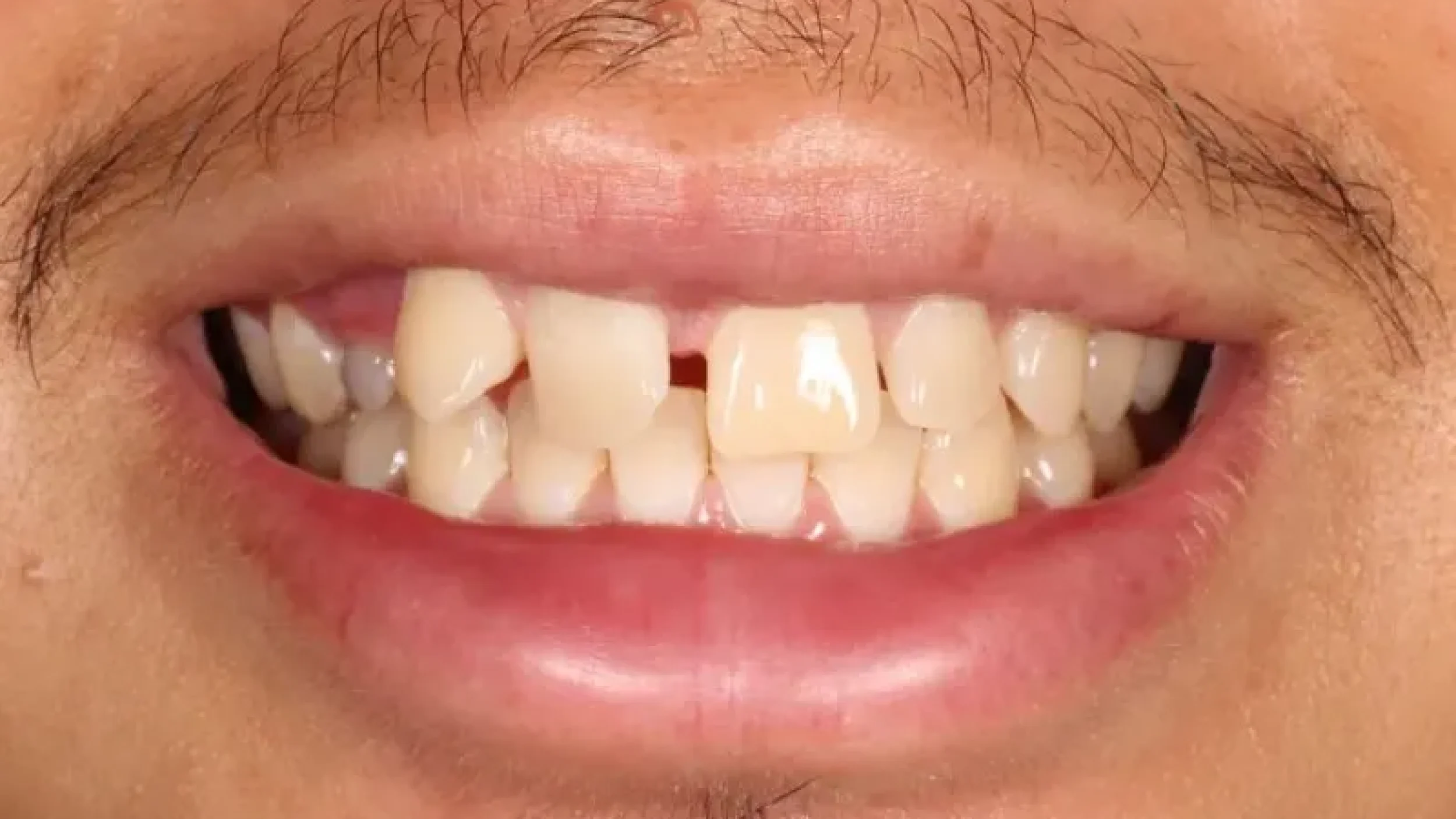 Gordon Dental Implants and Cosmetics Before After RR