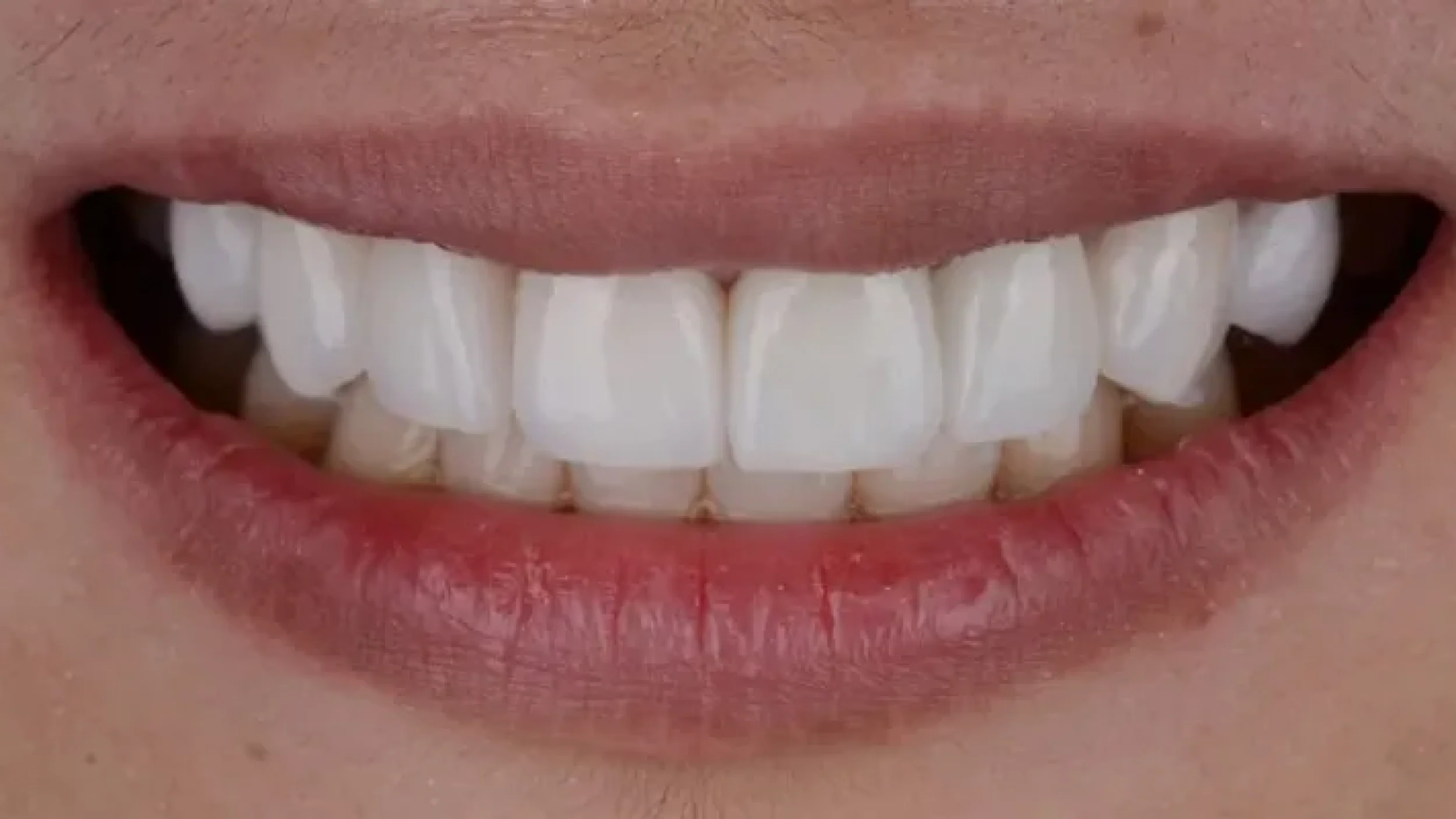 Gordon Dental Implants and Cosmetics Before After VV