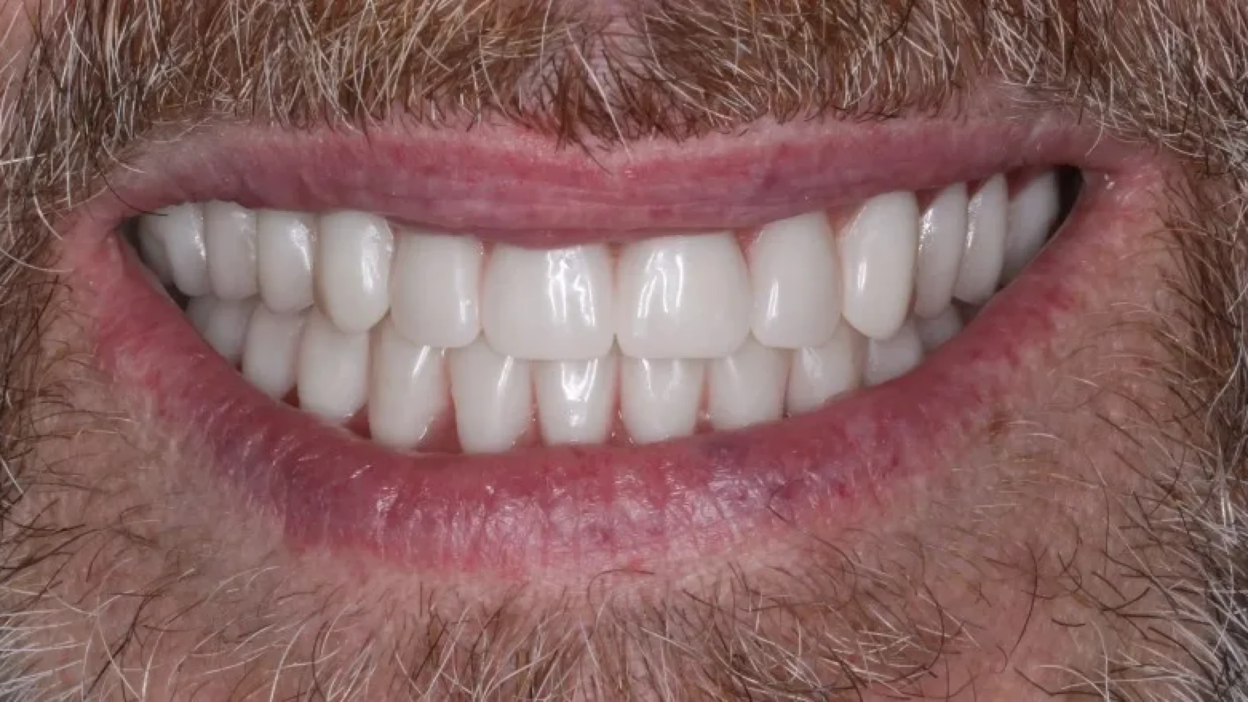 Gordon Dental Implants and Cosmetics Before After W