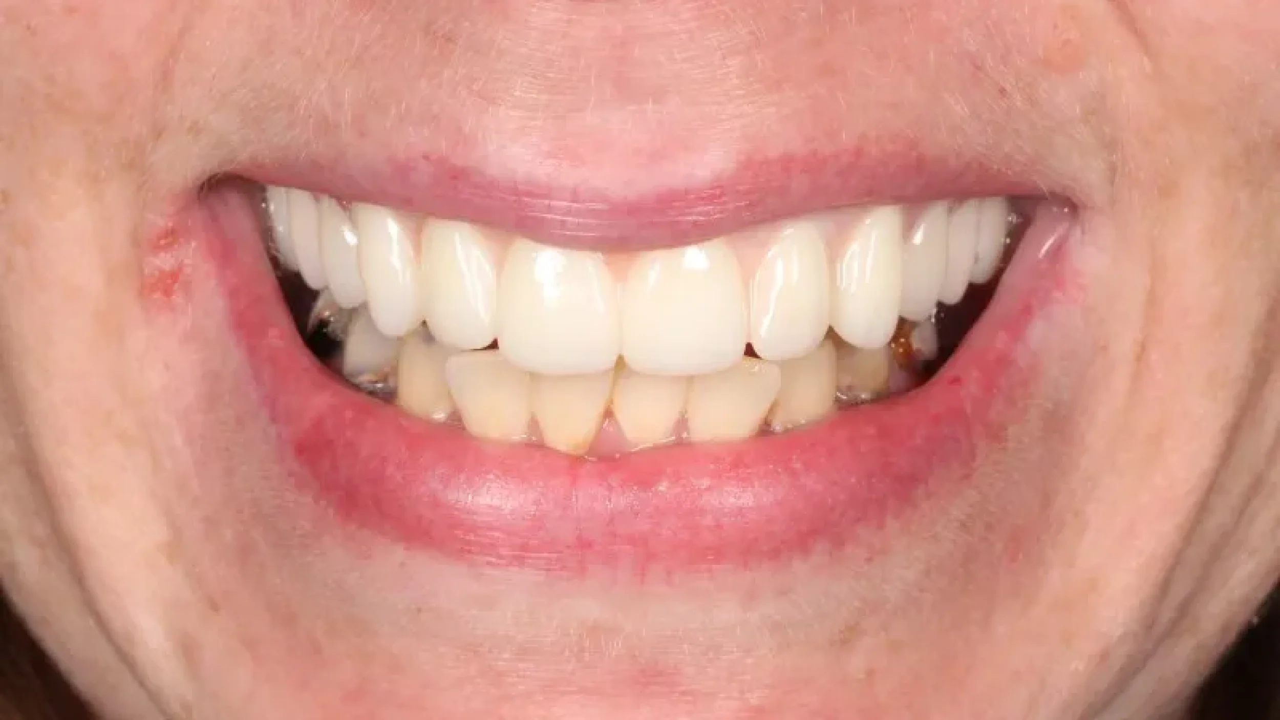 Gordon Dental Implants and Cosmetics Before After Z
