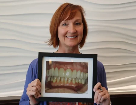 Gordon Dental Implants and Cosmetics Before and After H