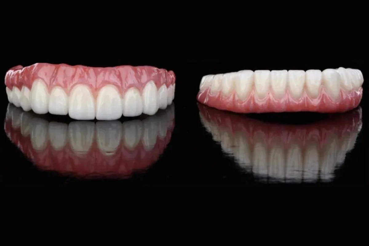 Leading Dental Implant Center in Kansas City, Overland Park, and Leawood Kansas