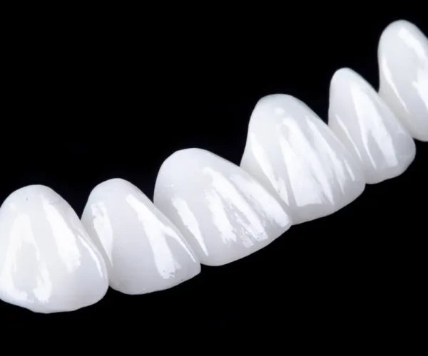 Premium Veneers in Kansas City at Gordon Dental Implants and Cosmetics