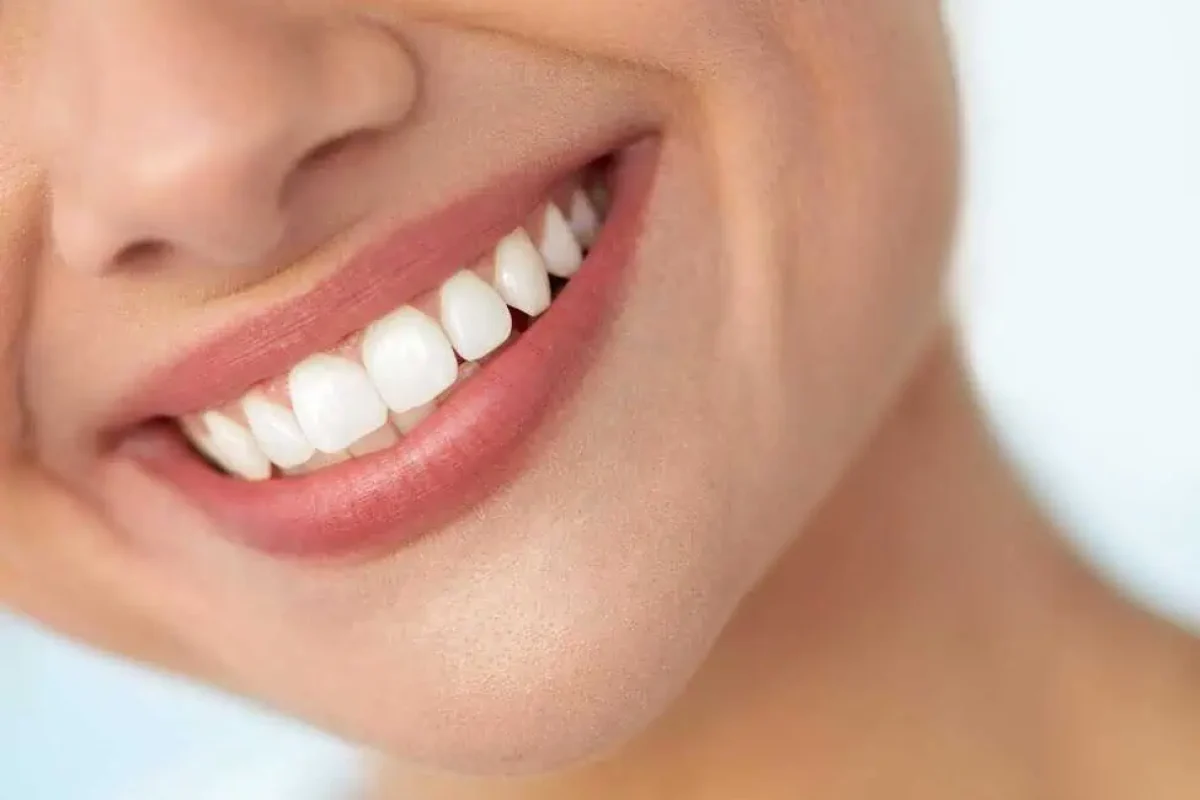Professional Teeth Whitening by Philip J Gordon DBSPA in Leawood, KS