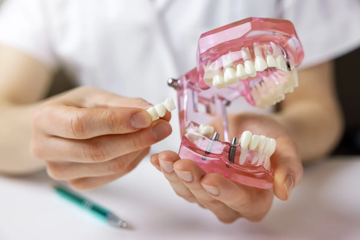 The Ripple Effect-How Missing Teeth Affect Your Jaw and Face in Kansas City