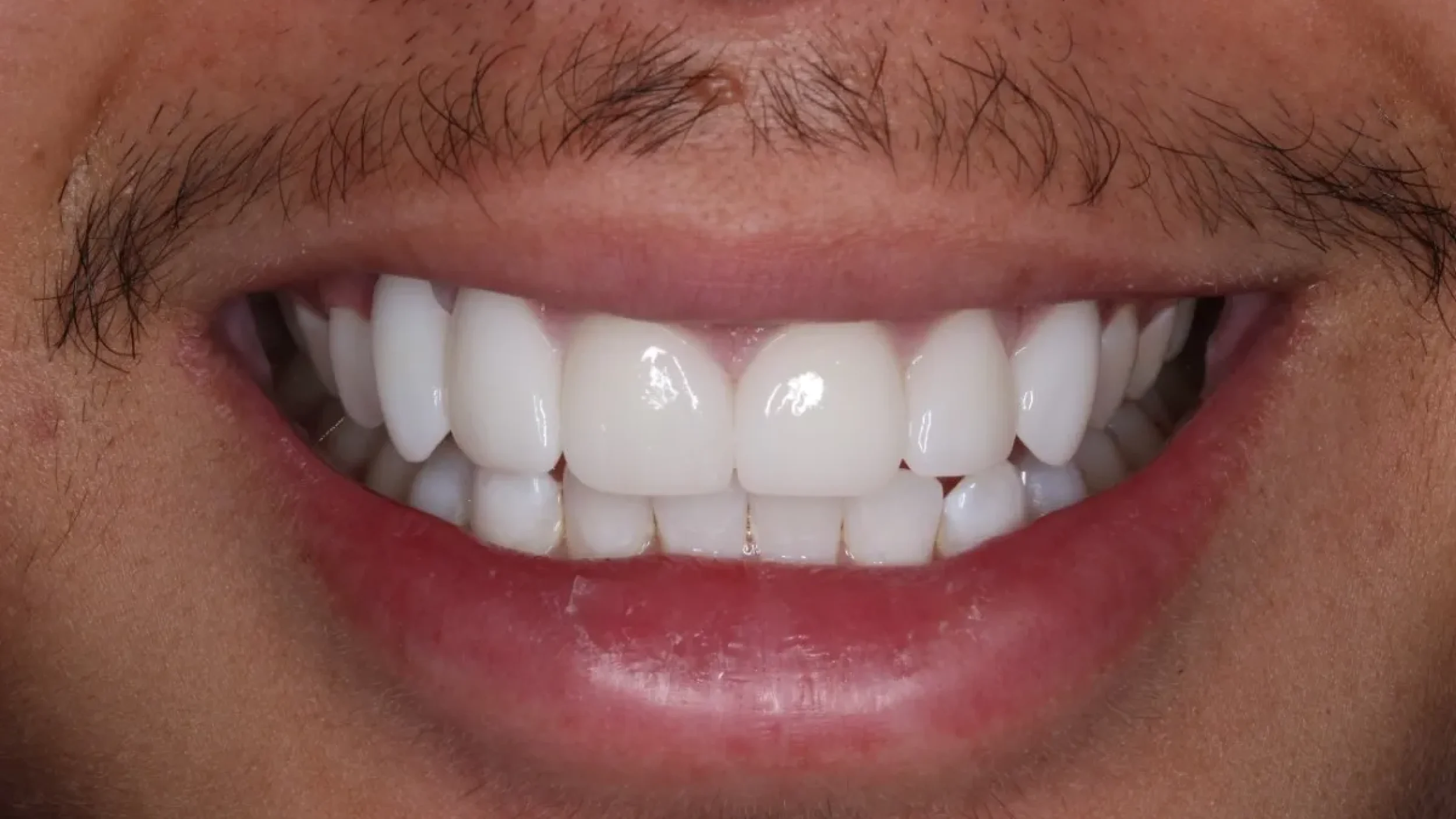 a close up of a person's teeth