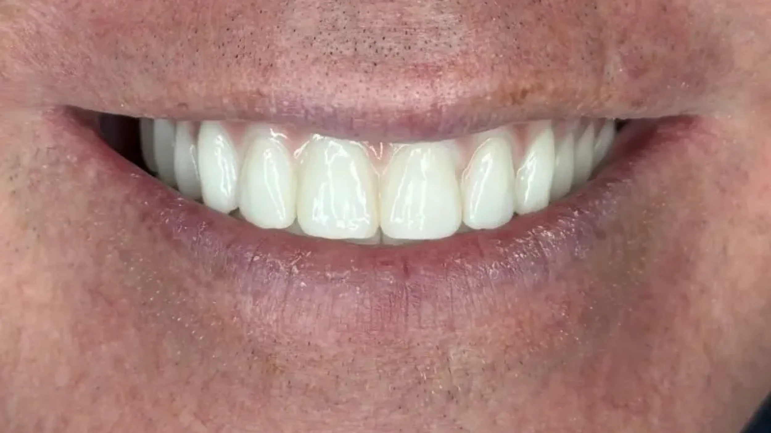 Gordon dental implants and cosmetics before after VV