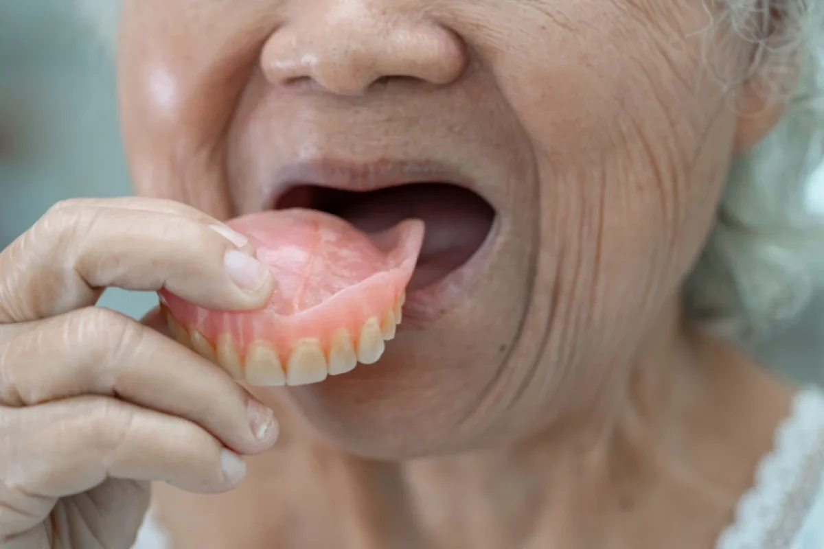 What’s the Better Long-Term Solution Dental Implants vs. Dentures