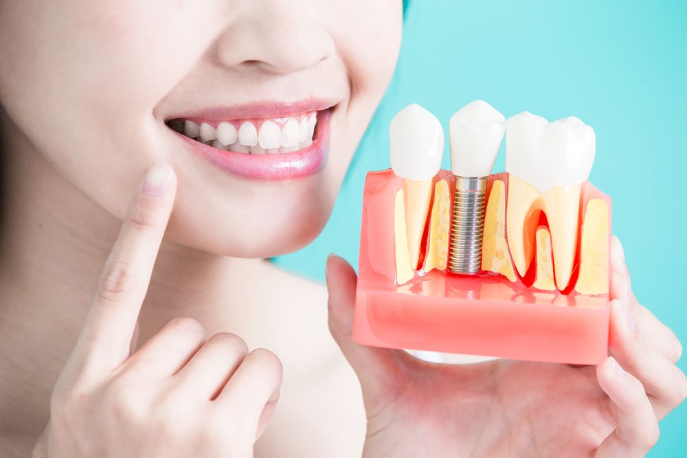 Regaining Your Confidence with Dental Implants