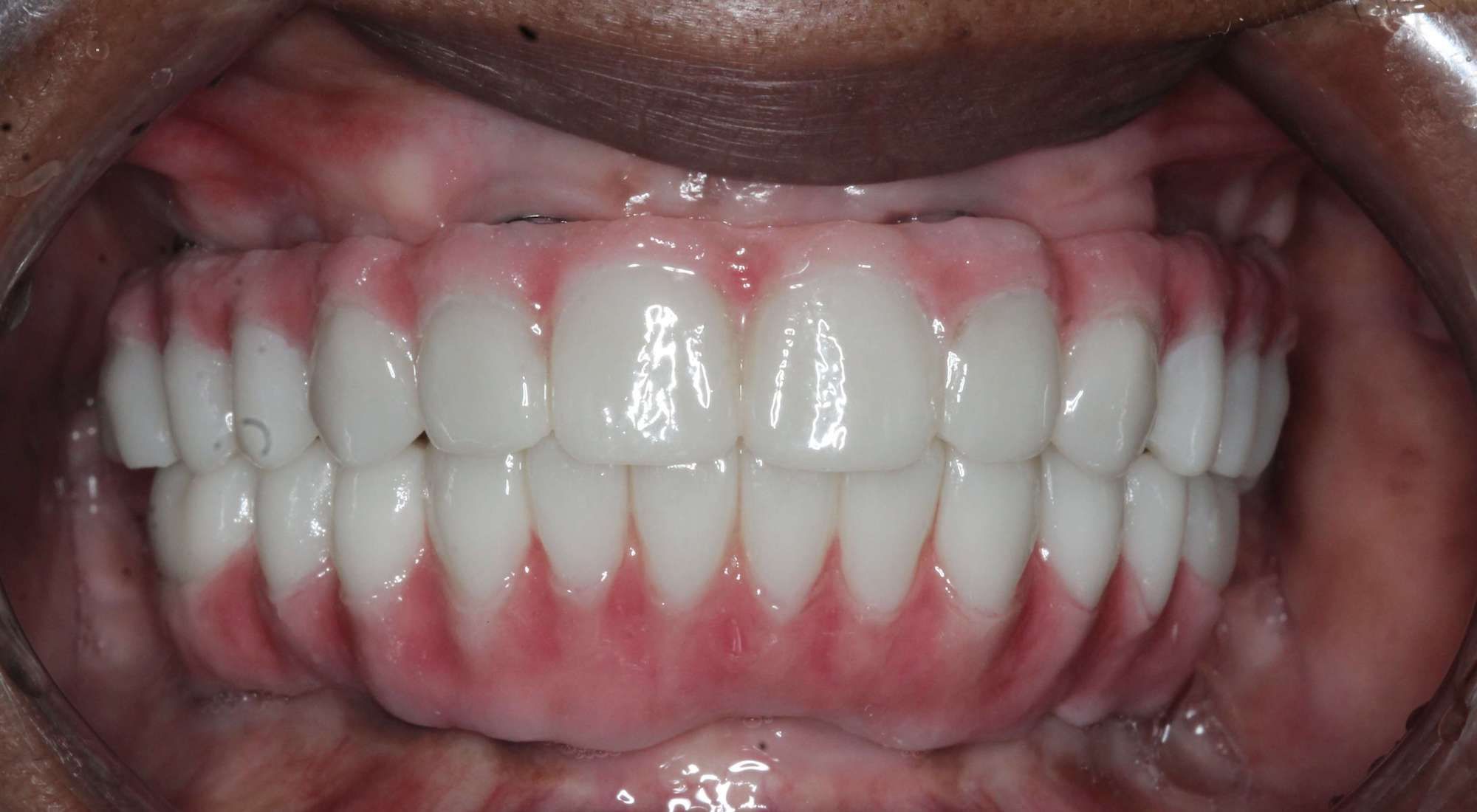 image of teeth