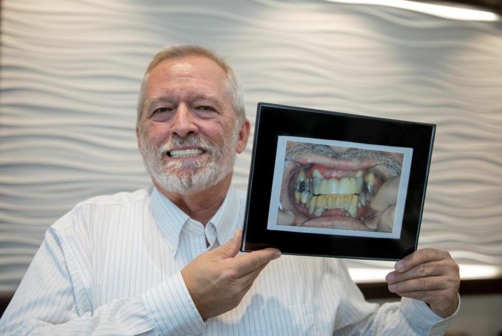 Man smiling with new dental implants