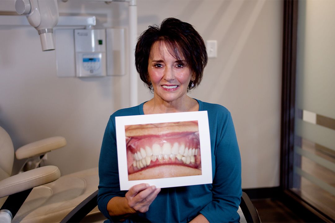 Dental Implant Patient Testimonial