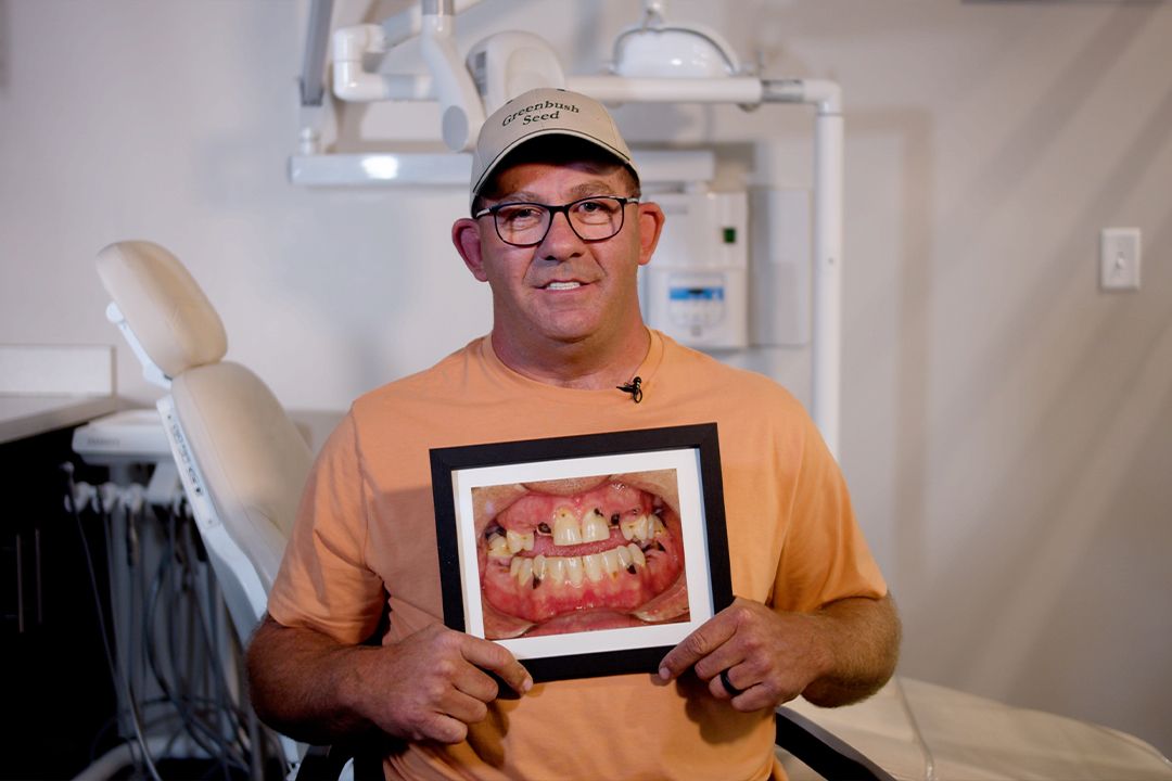 David's Before and After Dental Implant