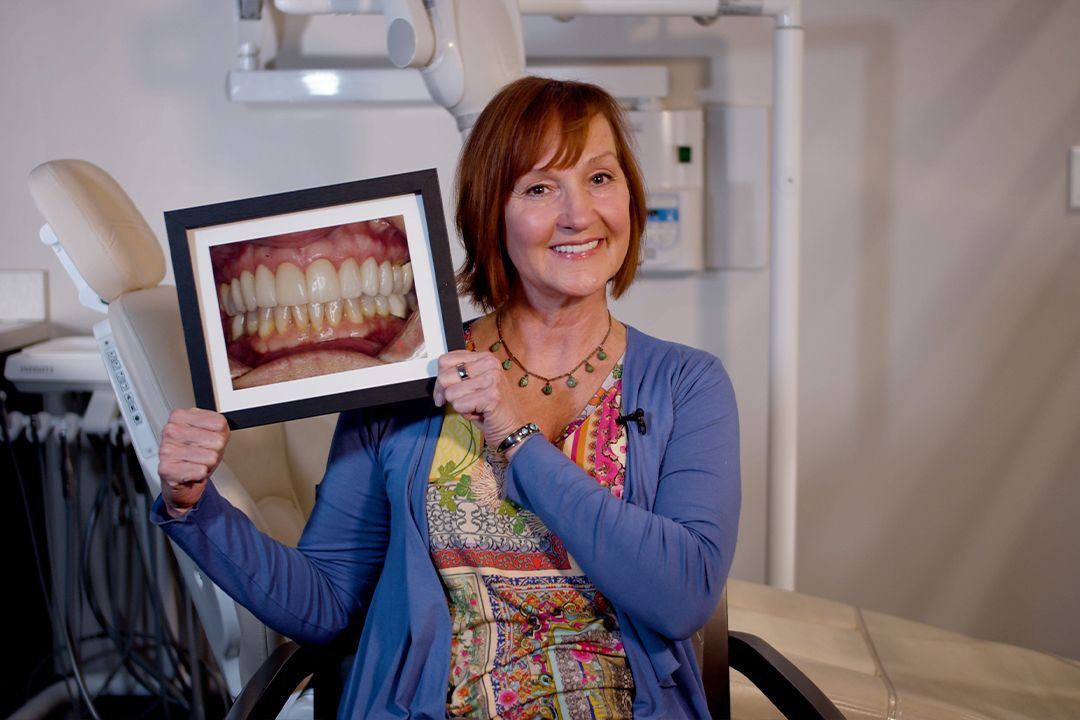 Jennifer's Before and After Dental Implants