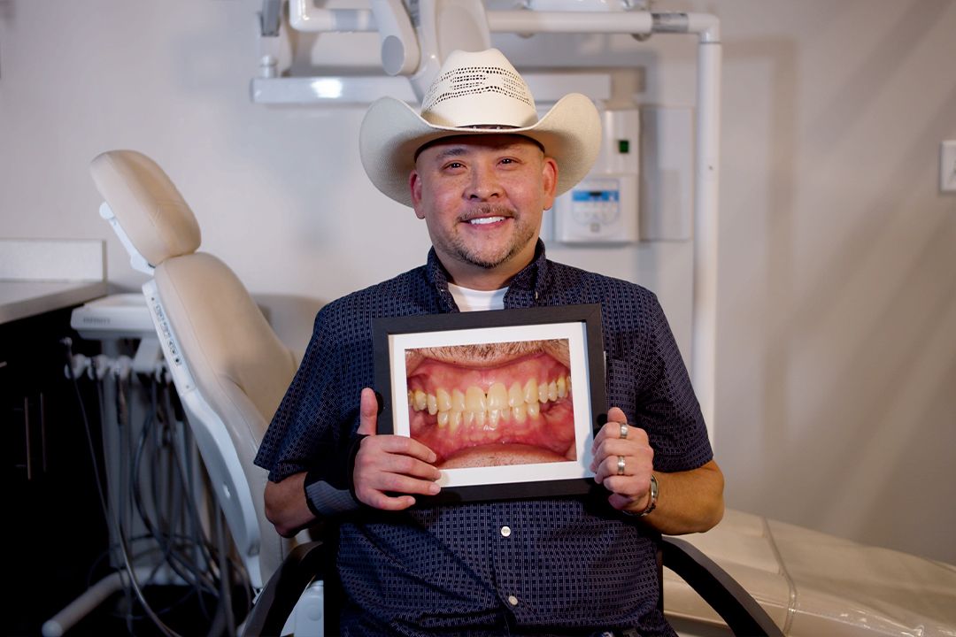 Mark's Before and After Dental Implants